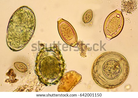 Eggs of helminth in stool, analyze by microscope