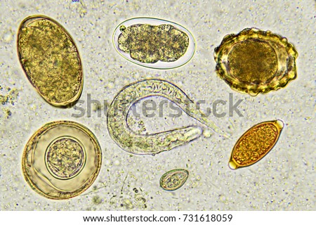 Eggs of helminthes in stool, analyze by microscope
