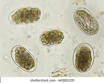 Eggs of Hookworm in stool, analyze by microscope
