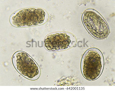 Eggs of Hookworm in stool, analyze by microscope