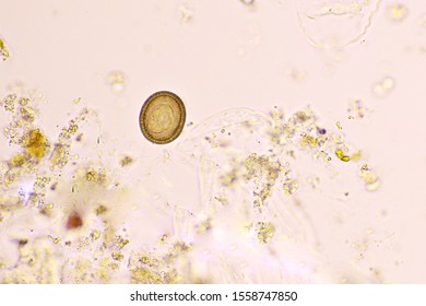 Eggs of Taenia or tapeworm in stool, analyze by microscope, original magnification 400x
