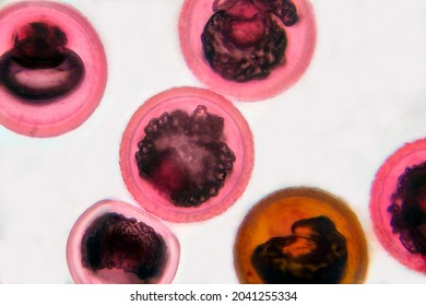 Eggs of tapeworm Taenia, pork tapeworm, a helminth transmitted to humans by raw or undercooked meat, light micrograph