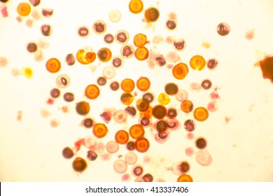 Eggs of tapeworm Taenia (pork tapeworm), a helminth transmitted to humans by raw or undercooked meat. Finding eggs in feces is used for diagnostics. Light microphotograph, magnification X100