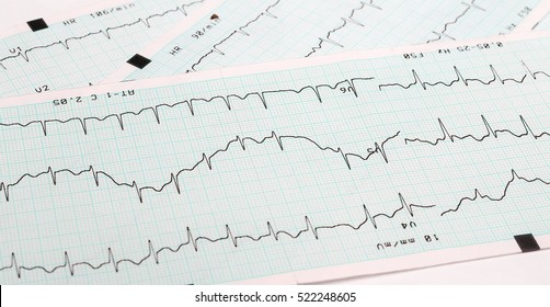 EKG Arrhythmia Absoluta, Printout Background