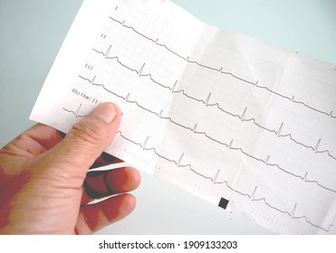 Ekg Heart Pulse On Graph Paper.