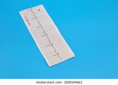 Ekg Isolate Paper Blue Background