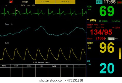 Ekg Monitor Stock Photo 475131238 | Shutterstock