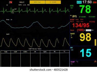 EKG Monitor