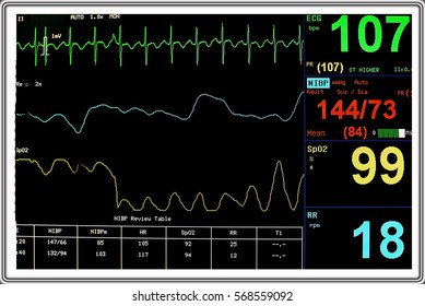 Ekg Monitor Stock Photo 660784234 | Shutterstock