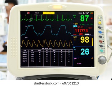 EKG Monitor