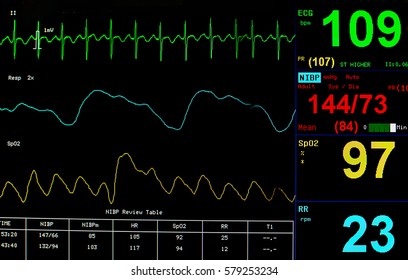 EKG Monitor At ICU In Hospital