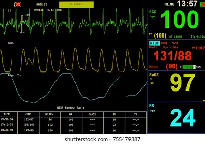 Ekg Monitor Icu Hospital Stock Photo 755479387 | Shutterstock