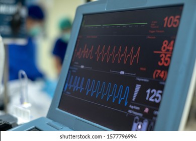 Ekg Monitor Intra Aortic Balloon Pump Stock Photo 1577796994 | Shutterstock