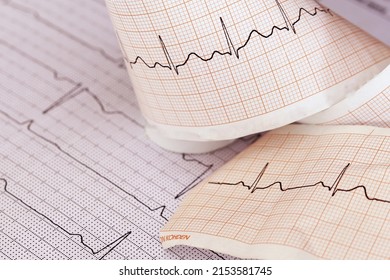 Ekg Paper Placed On A Notebook, Used For Diagnosis Of Doctors To Diagnose Heart Disease