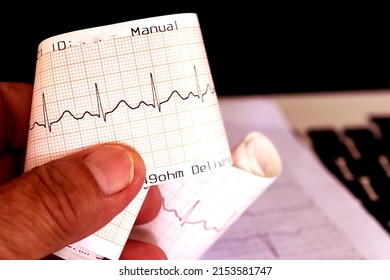 Ekg Paper Placed On A Notebook, Used For Diagnosis Of Doctors To Diagnose Heart Disease