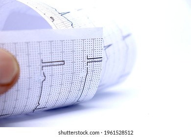 Ekg Paper Showing ECG Results, White Background.