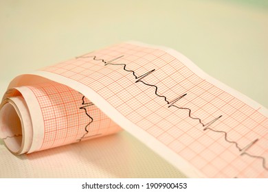 ekg paper showing the results of the electrocardiogram There is a medicine bottle placed on the side.