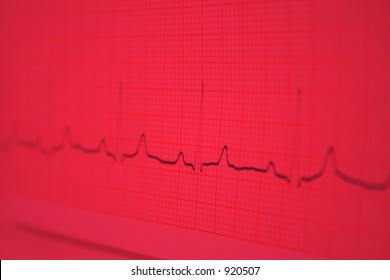 Ekg Red