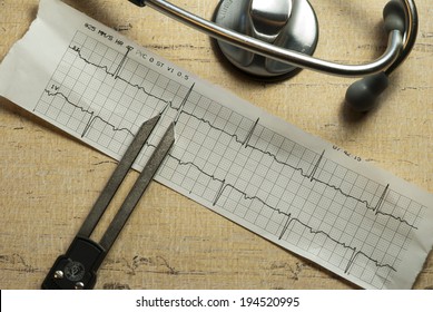 EKG Strip With Calipers And Stethoscope