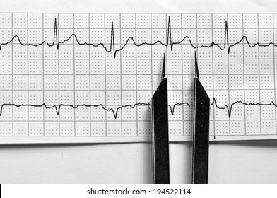 EKG Strip With Calipers/Normal Sinus Rhythm