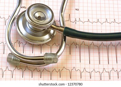 A Ekg Strip From A Health Clinic