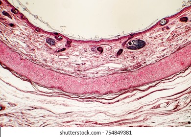 Elastic cartilage of human outer ear, light micrograph
