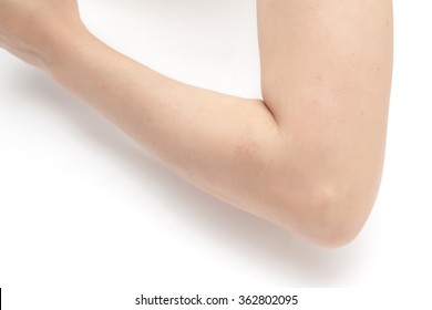 手肘图片 库存照片和矢量图 Shutterstock