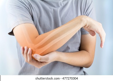 Elbow Bones Injury