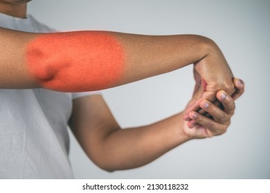 Elbow Injury From Tennis And Golf. The Man Uses Fingers To Massage And Stretch His Arm. Pain Symptom Area Is Shown With Red Color. Healthcare Knowledge. Medium Close Up Shot.