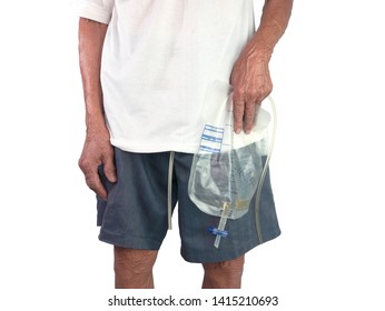 An elderly Asian man suffering from pain in the urinary system, Isolated on white background. Diseases for men. Enlarged prostate.Urinary catheter.