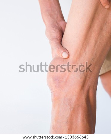 Elderly hands holding legs in the area of the knee that is inflamed on a dark background