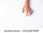 Elderly hands with wrinkled skin showing signs of finger pinching on a white background