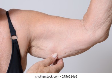 Elderly Lady Displaying The Loose Skin Or Flab Due To Ageing On Her Upper Arm Pinching It Between Her Fingers, Close Up View