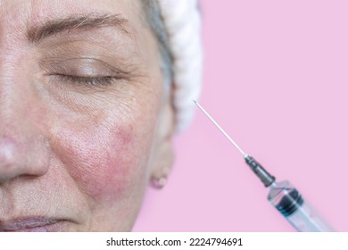 elderly senior gray haired grandmother granny woman with rosacea problematic skin use syringe with solution anti wrinkle aging treatment.isolated female lady on pink wearing headband,free space copy  - Powered by Shutterstock