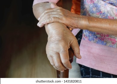 Elderly Swollen Hand Or Edema Hand