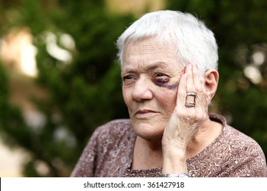 Elderly Woman With Black Eye Holding Hand To Her Eye.