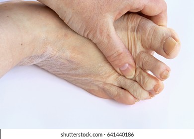 An elderly woman has pain in the feet and toes