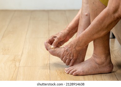 Elderly woman massage her foot with painful swollen gout inflammation