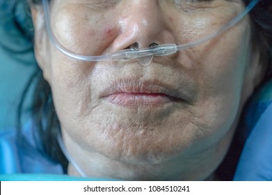 Elderly Woman With Nasal Breathing Tube To Help With Her Breathing