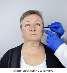 An Elderly Woman At The Reception Of A Facial Plastic Surgeon. Consultation On The Removal Of Age Wrinkles On The Face. The Doctor Shows What Procedures He Will Do. Mimic Wrinkles. Contour Plastic