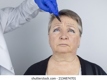 An Elderly Woman At The Reception Of A Facial Plastic Surgeon. Consultation On The Removal Of Age Wrinkles On The Face. The Doctor Shows What Procedures He Will Do. Mimic Wrinkles. Contour Plastic