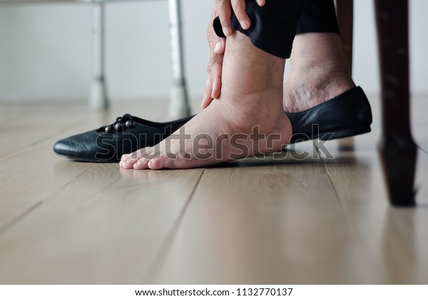 Elderly woman swollen\
feet putting on shoes