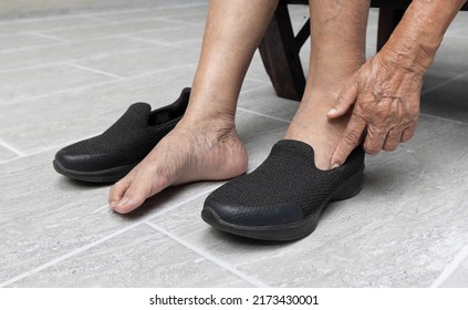 Elderly Woman Varicose Veins Feet Puts On A Shoes At Home.