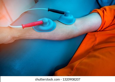 Electro stimulation therapy on arm of  asian man.Muscle stimulator therapy technology.