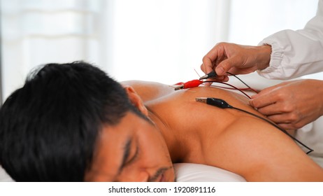Electro-Acupuncture. Chinese acupuncture and electric acupuncture on the patient's body to treat pain.