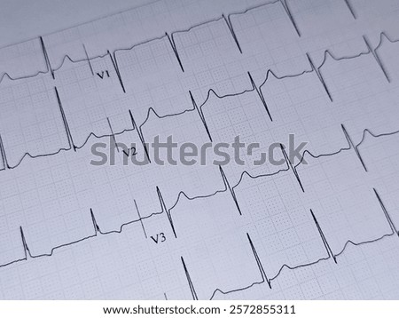an electrocardiogram ECG or EKG, within normal ECG for a 55 years old male, a recording of the heart's electrical activity through repeated cardiac cycles, Electrocardiography for the heart
