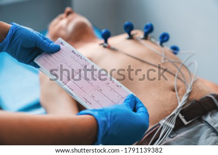 Electrocardiogram, ECG in hand. Cardiogram printout on male patient background