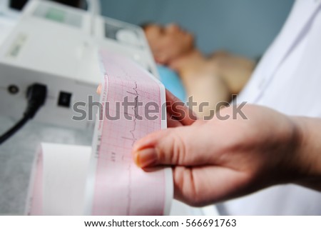Electrocardiogram, ECG in hand. Clinic of Cardiology heart rate and pulse test closeup. Cardiogram printout on a male patient background