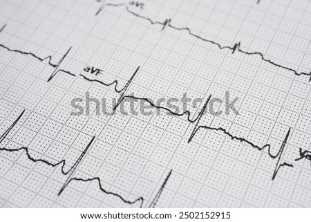 Electrocardiogram (ECG), heart wave, heart attack, cardiogram report.