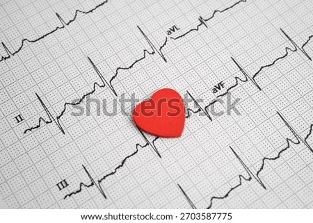 Electrocardiogram ECG, heart wave, heart attack, cardiogram report.